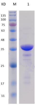 12% SDS-PAGE analysis profiles of purified PA0931-29-318 (CBB stained).
